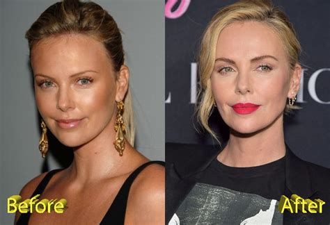 Charlize Theron Before And After Cosmetic Surgery Plastic Surgery