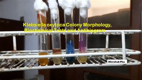 Klebsiella Oxytoca Colony Morphology And Biochemical Tests Youtube