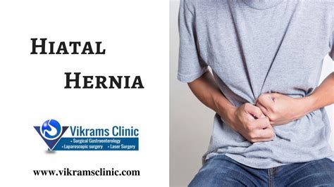 Pdf Hiatal Hernia Treatment In Chennai Laparoscopic Surgery In
