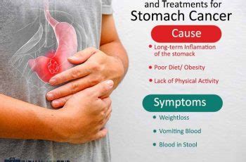 Later, it often causes coughing, wheezing, and chest pain. What Does A Cancerous Lump Feel Like In The Neck - Cancer ...