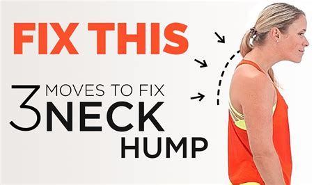 Best Neck Hump Exercises Fix Your Hunch Back Fast Youtube