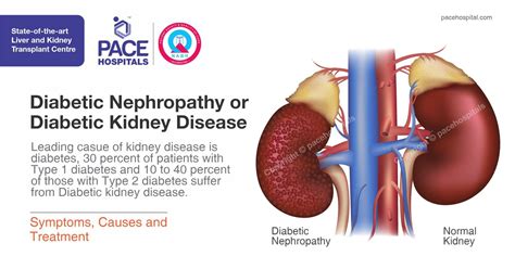 Diabetic Nephropathy Symptoms Causes Diagnosis And Treatment