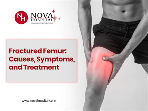 Fractured Femur Causes Symptoms And Treatment Nova Hospital