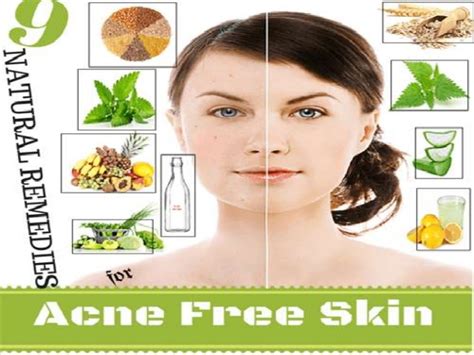 All Natural Acne Treatments Acne Diet