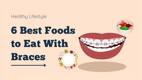 6 Best Foods To Eat With Braces Healthy Lifestyle