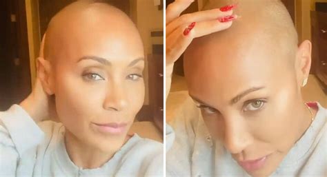 jada pinkett smith gets candid about her struggle with alopecia vt
