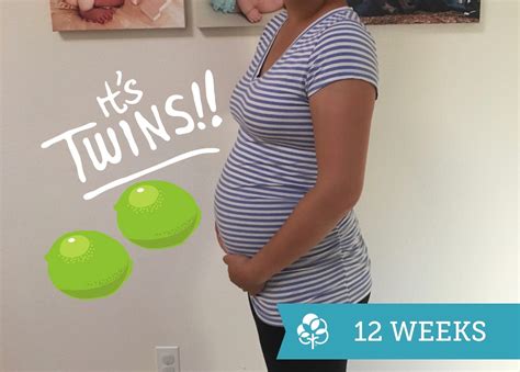 12 Semanas De Embarazo De Gemelos Consejos Recomendaciones Y Cómo