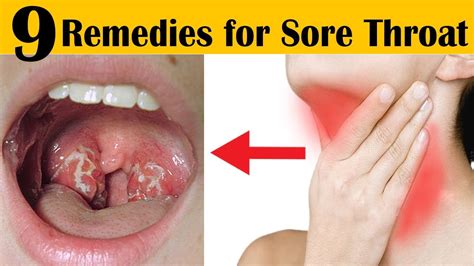I have a cold, with sore throat, lot of coughing, no body aches; How to Get Rid of a Sore Throat Fast Overnight - 9 Home ...