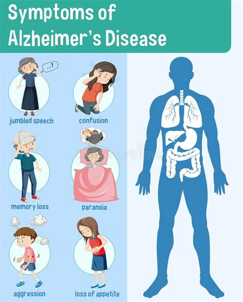 Symptoms Of Alzheimer S Disease Infographic Stock Vector Illustration