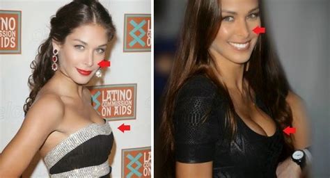 Dayana Mendoza Plastic Surgery Nose Job Breast Implants Before And