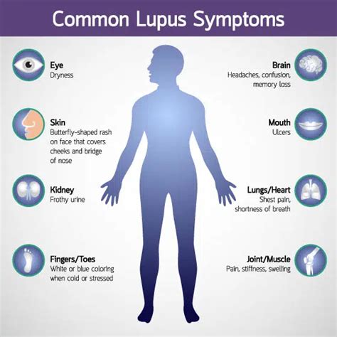 Lupus Specialist And Treatment Brisbane Au