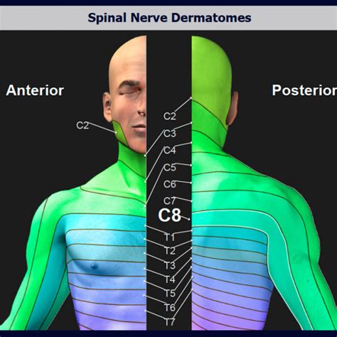 Spinal Nerve Dermatomes Trialexhibits Inc The Best Porn Website