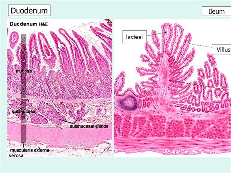 Image Result For Small Intestine Ileum Histology Lacteals