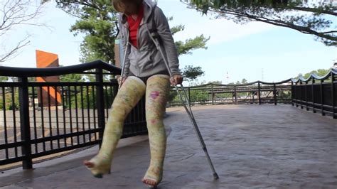 Emily With 2 Broken Legs Youtube