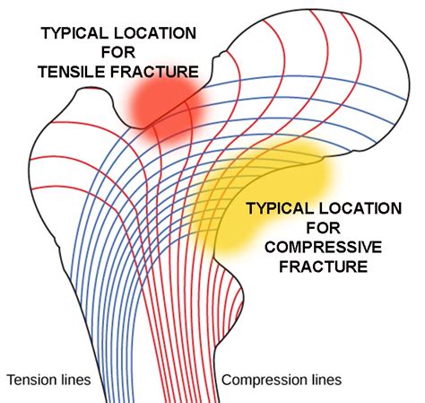 Sports Injury Bulletin Diagnose And Treat Uncommon Injuries Dont