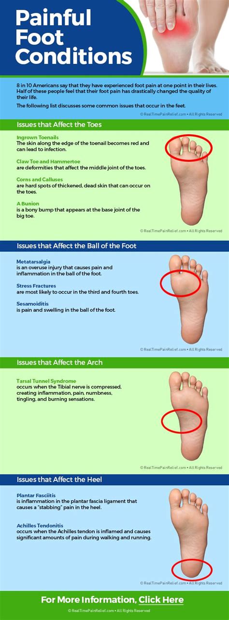 Bottom Of Foot Chart