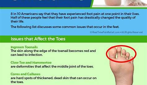 heel pain diagnosis symptoms