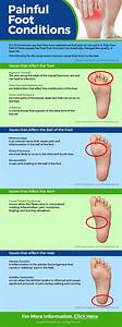 Pin On Foot Relief Tips