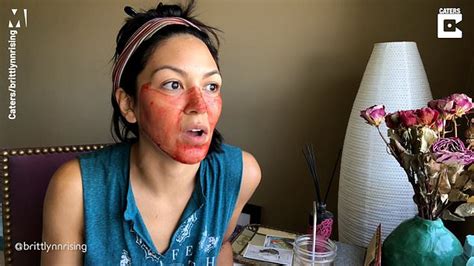 Woman Uses Period Blood As A Face Mask And Says Its Made Her Skin