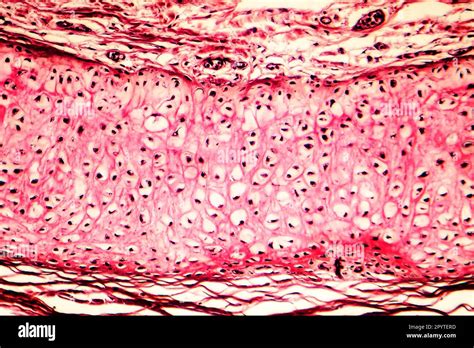 Elastic Cartilage Of Human Outer Ear Light Micrograph Stock Photo Alamy