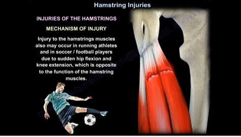 Hamstrings Injuries —
