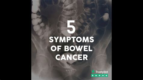5 Symptoms Of Bowel Cancer Youtube