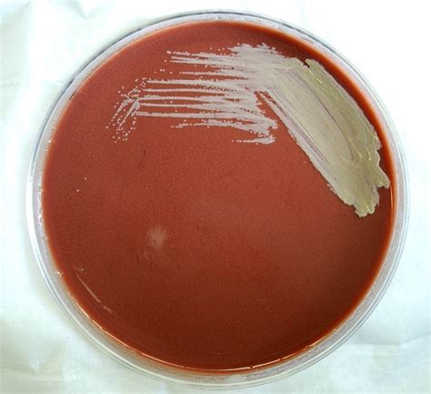Free Picture Francisella Tularensis Colonies Grown Chocolate Agar