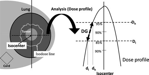 The Scheme Of The Lung Tumor And Isodose Line Left And The Dose