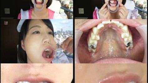 Deviant Dentist Mouth Fetish Mania Maid Playful Mouth Stretching And