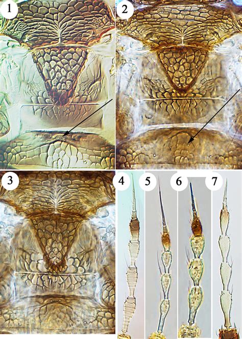 Heliothrips Species Mesonotum Metanotum And Tergite I 13 1