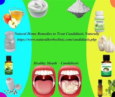 Natural Remedies For Candidiasis