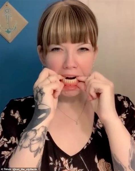 Gastric Bypass Side Effects Woman 32 Reveals Her Teeth Fell Out Due