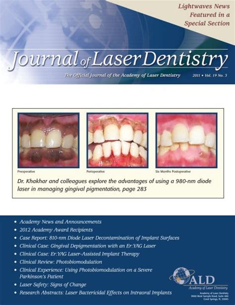Academy Of Laser Dentistry