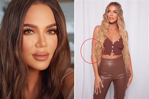 Khloe Kardashian Looks Unrecognizable In Migraine Ad After Suffering Major Photoshop Fail The