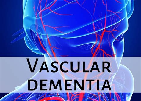 Vascular Dementia Complete Guide Readementia