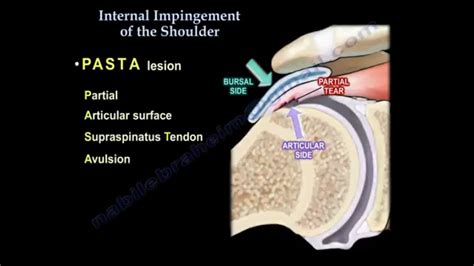 Grays Integrative Physiology Shoulder Internal Impingement