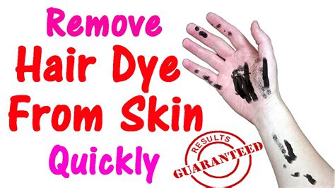 6 Ways To Remove Hair Dye From Skin At Home How To