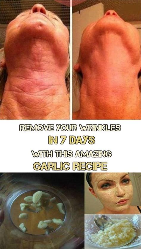 Remove Your Wrinkles In 7 Days With This Amazing Garlic Recipe