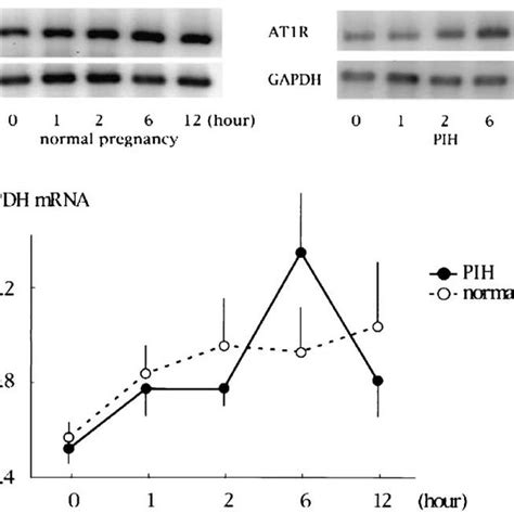 Changes Of Angiotensin Ii Receptor Subtype 1 At1r Mrna Expression In