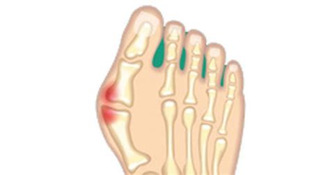 Inside Foot Pain Archives
