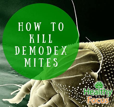 How To Kill Demodex Mites Healthy Focus