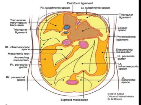 Applied Radiological Anatomy Of Retroperitoneum And Peritoneal Spaces Ppt