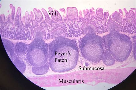 Ileum Histology