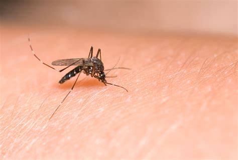 Mosquito Bite Allergy
