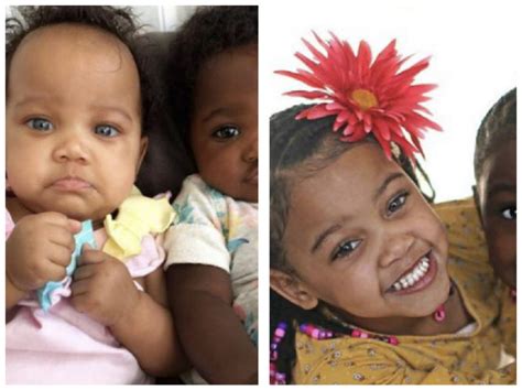 Unique Twins What Sisters Born With Different Skin Colors Look Like Now