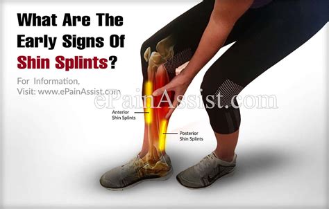 21 Schlau Fotos Pain On Inner Side Of Shin Bone Shin Splints