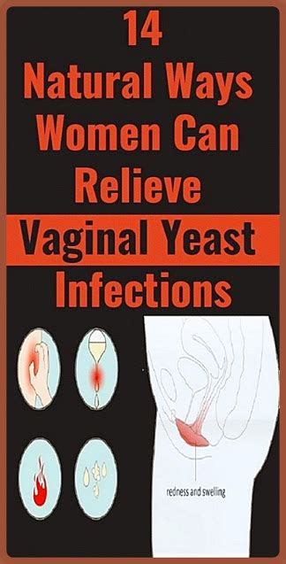14 Natural Treatments For A Vaginal Yeast Infection Healthy Lifestyle