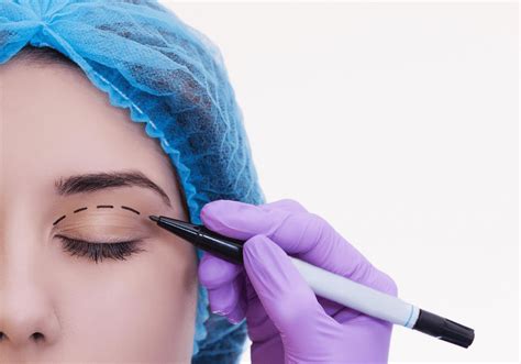 Why Finding The Best Blepharoplasty Surgeon Matters Rostami Opc