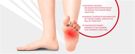 Relieve Ball Of Foot Pain Fast Get Expert Treatment With Prescription