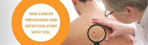 American Academy Of Dermatology Skin Cancer Screening Doctorvisit